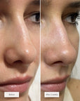 CLEAR PORE DUO