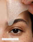 FOREHEAD PATCHES