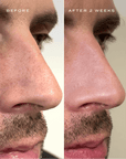 CLEAR PORE DUO